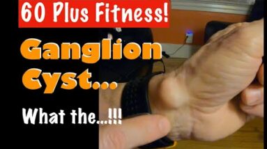 Ganglion Cyst On My Wrist!